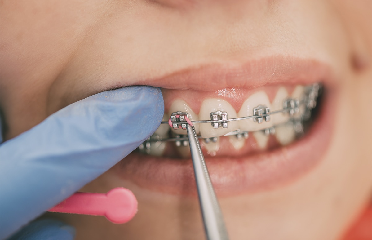 Hay distintos factores por los que un seguro de salud puede subir de precio. ¿Quieres conocerlos?